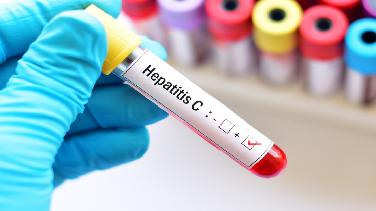 Hepatitis: Debunking common myths and misconceptions