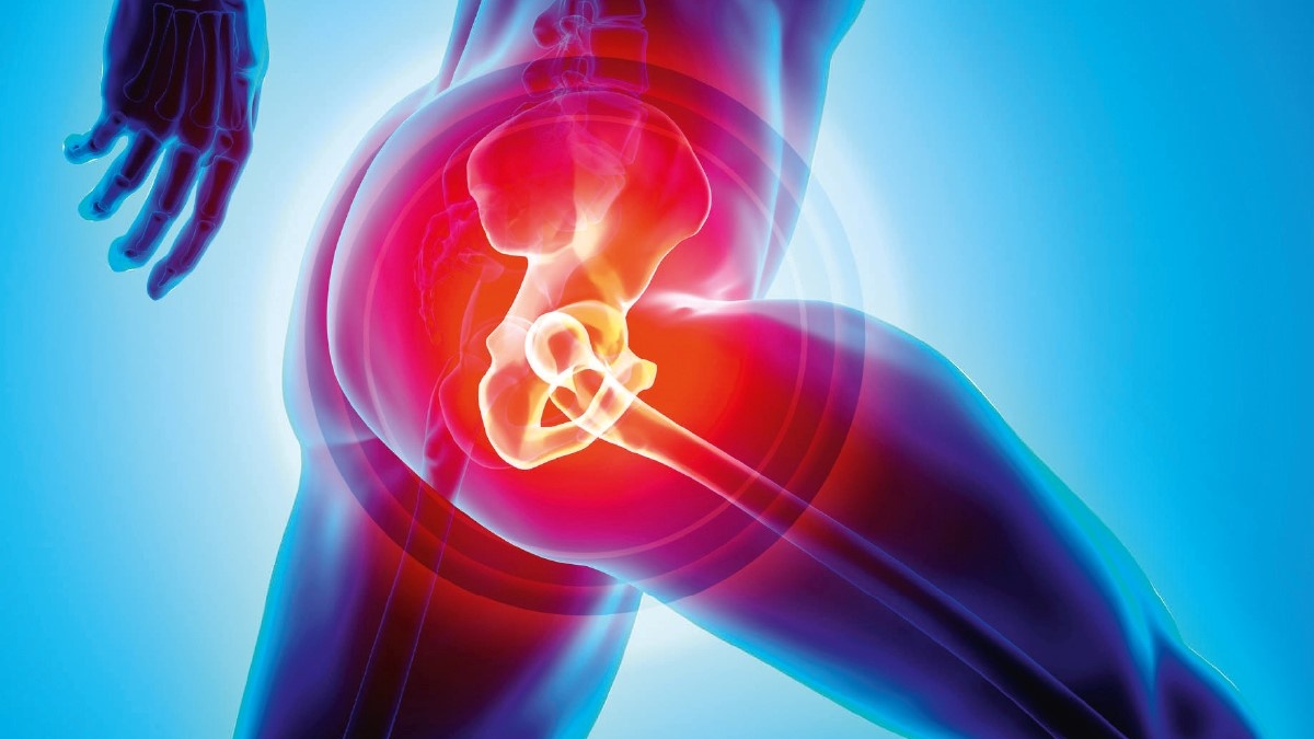 Hip arthritis is now common among adults too