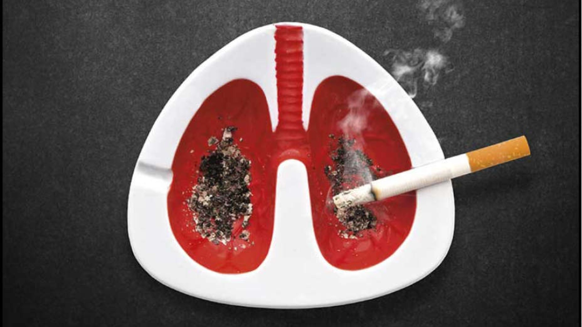 THE TRIPLE THREAT OF SMOKING: LUNG CANCER, COPD & PNEUMONIA