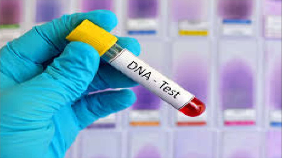 DNA sampling: An ignored yet a cardinal domain of evidences