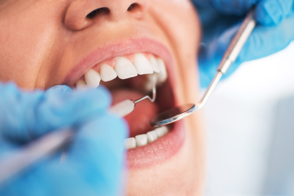 DENTAL IMPLANT IS A SAFE AND EFFECTIVE PROCEDURE