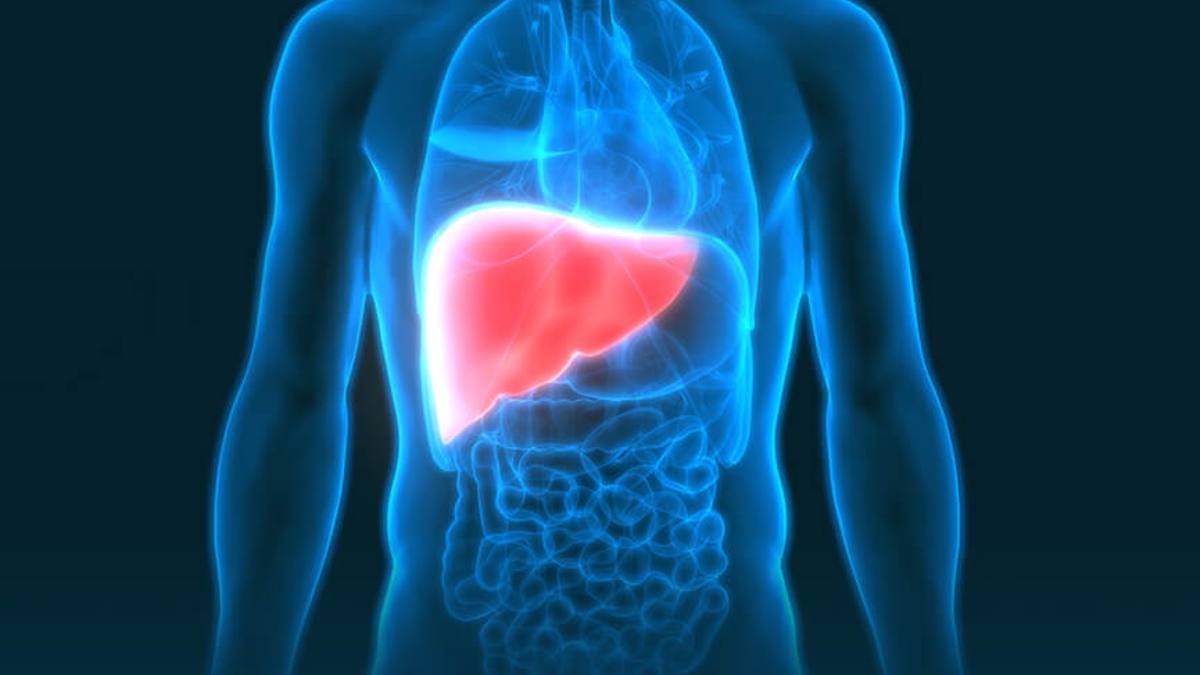 KNOW ABOUT NON-ALCOHOLIC FATTY LIVER DISEASE