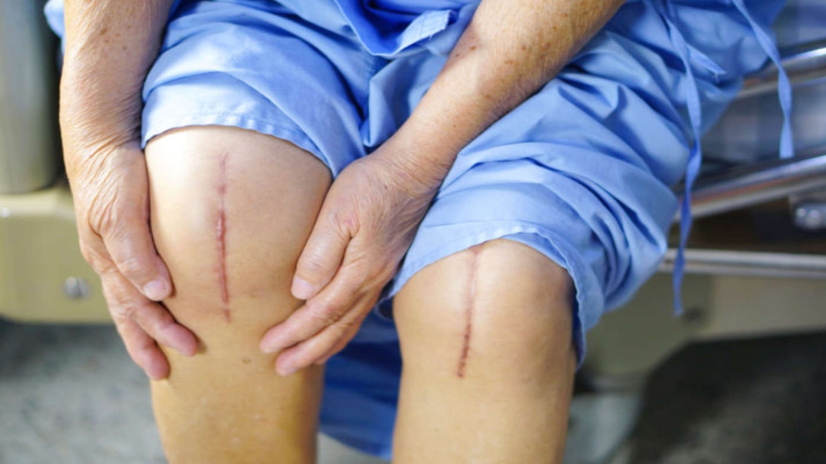 Pain after knee replacement surgery: When to see a doctor?