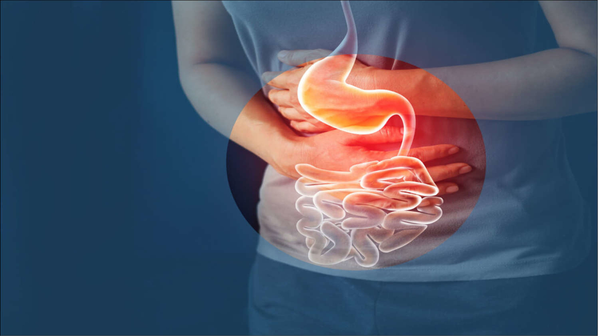 Why Acid Reflux And Irritable Bowel Syndrome Cases Are Increasing