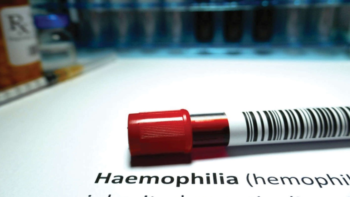 UNDERSTANDING HAEMOPHILIA: CAUSES, RISK AND TREATMENT