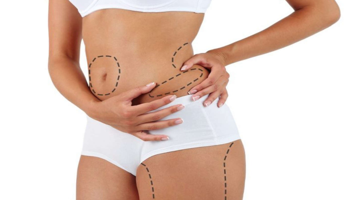 Body contouring: Enhanced skin and sculpted body