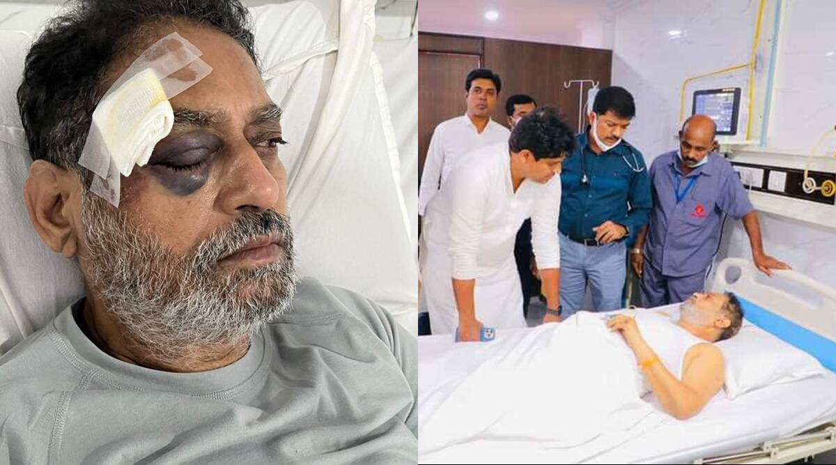 Bharat Jodo Yatra: Congress leader Nitin Raut injured in Telangana