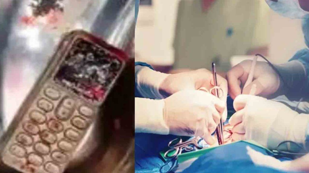 15-year-old girl swallows cell phone in Gwalior