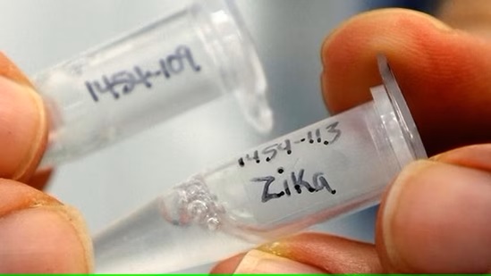 Second Zika case in Mumbai; 15-year-old girl in hospital and stable