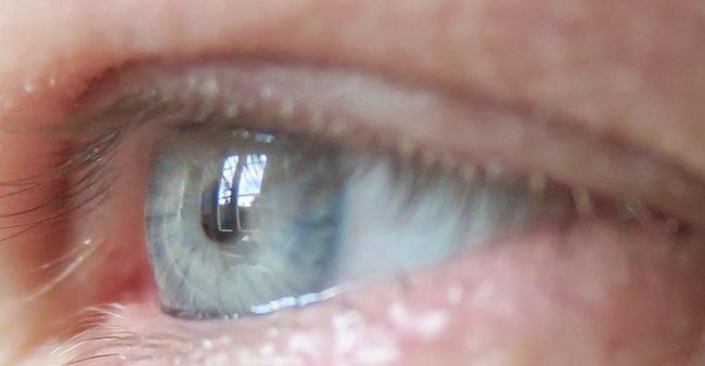 Study reveals how eye implants could also treat Diabetes