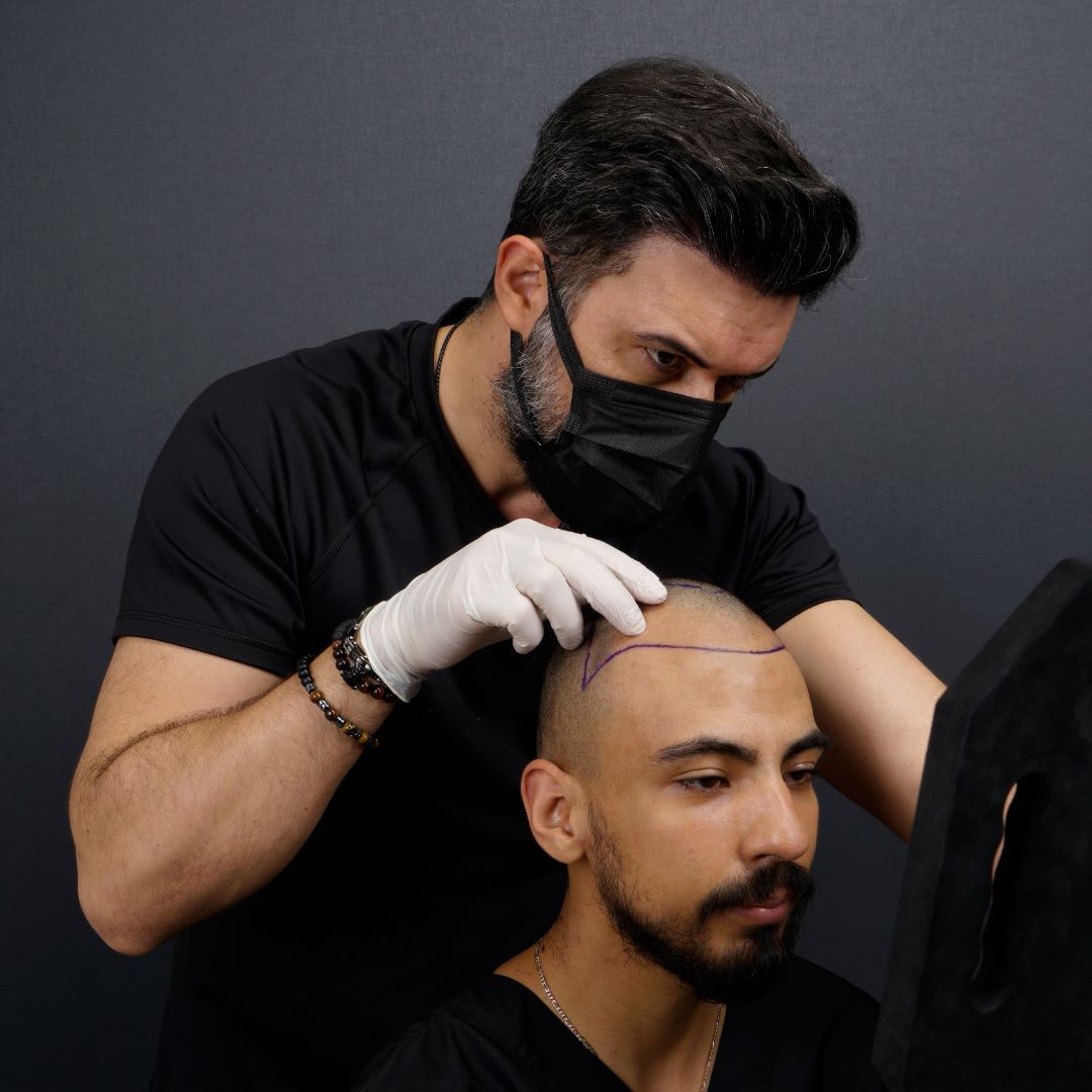 How Much Does Hair Transplant Cost? Exploring Options, Tips, and Aftercare