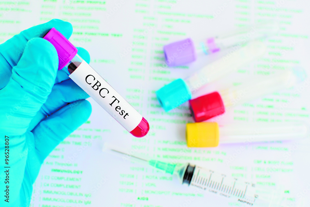 Prioritizing Prevention: The Top 5 Blood Tests You Should Include in Your Annual Health Checkup