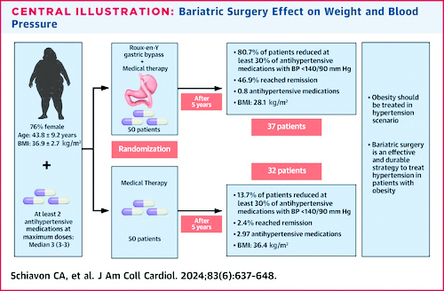 Bariatric Surgery outperforms meds in obesity-linked hypertension