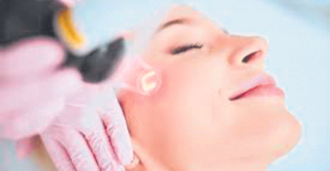 Revolutionizing Acne Scar Treatment: The Power of Fractional Laser Technology