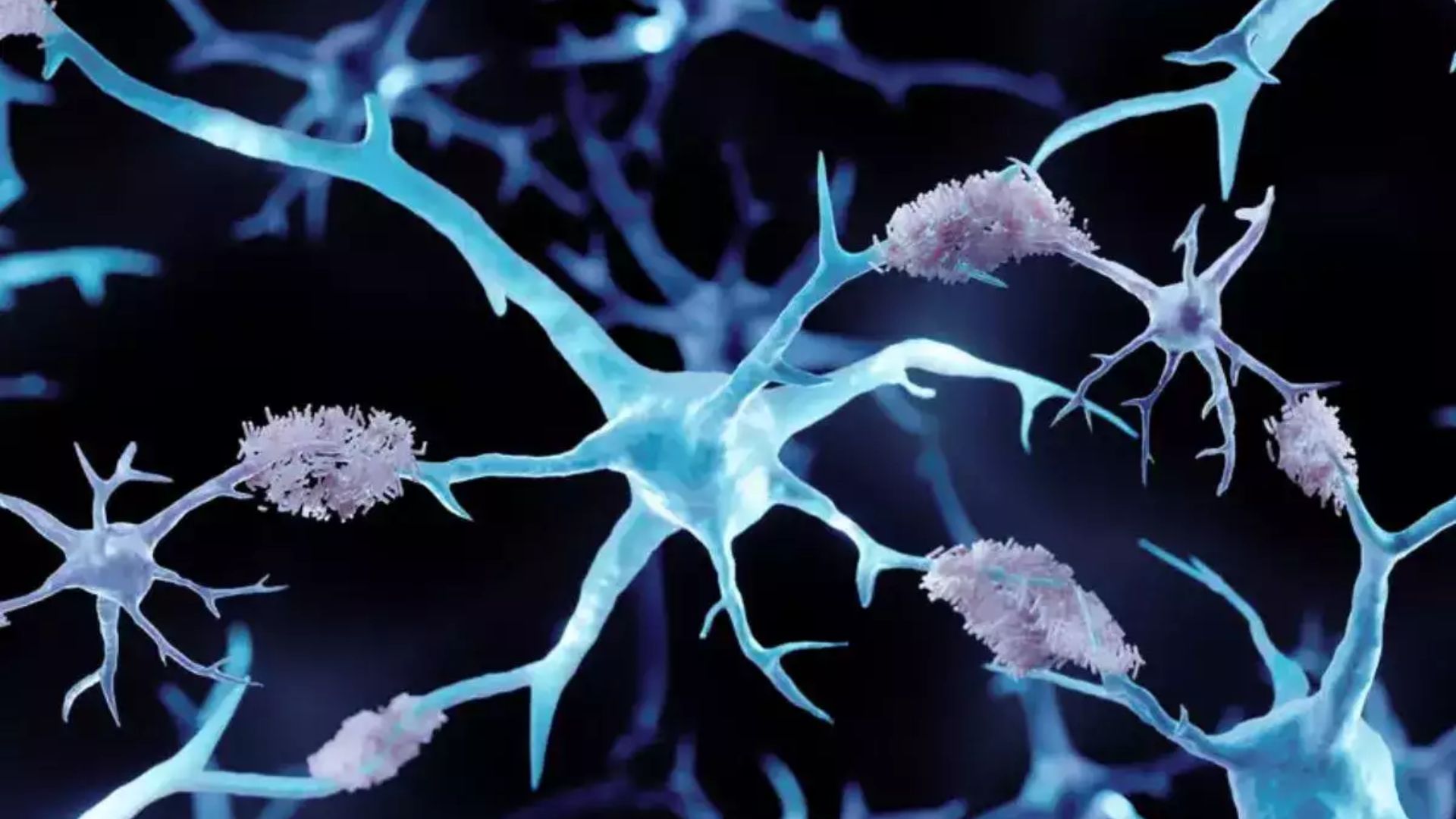 New mRNA method targets Tau Protein in Alzheimer’s disease