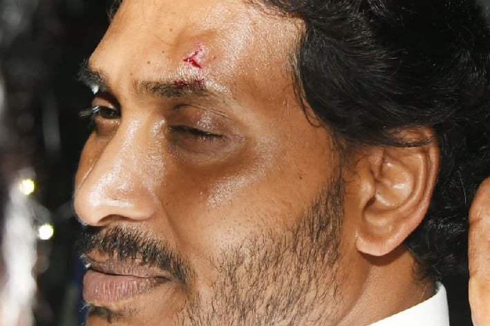 CM Jagan Reddy Sustains an Injury in a Stone-Pelting Incident