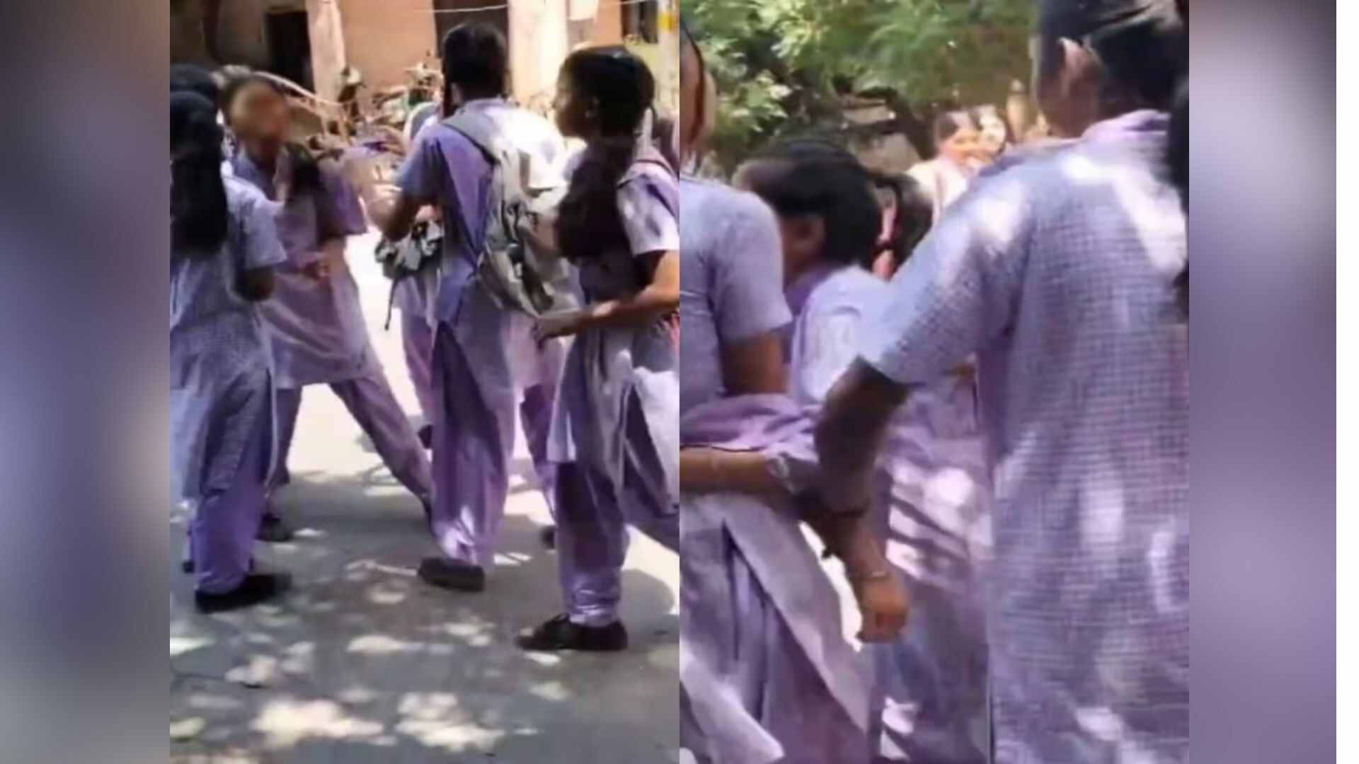 Delhi: 14-Year Old Girl Assaulted By Classmates, Gets 17 Stitches On Face