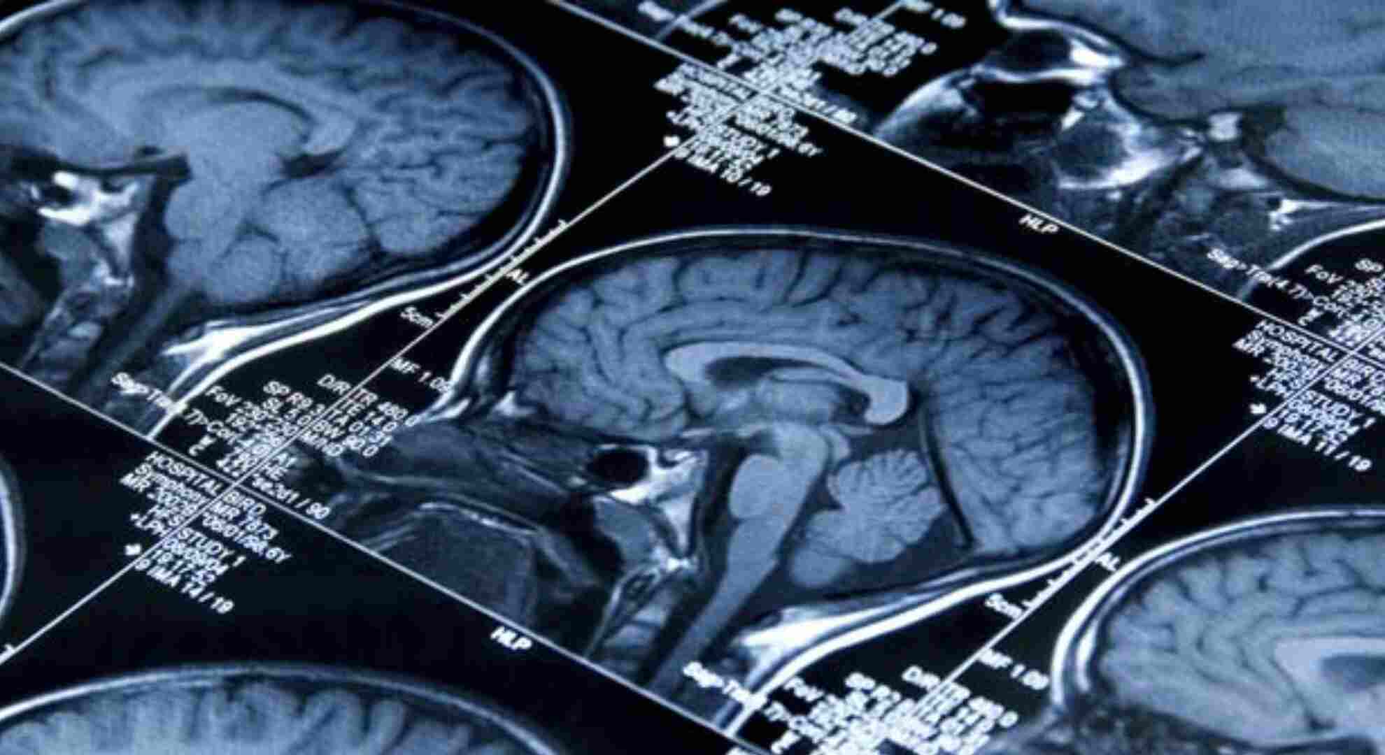 Rare Brain Infection Surfaces in Kerala: Fourth Case Reported