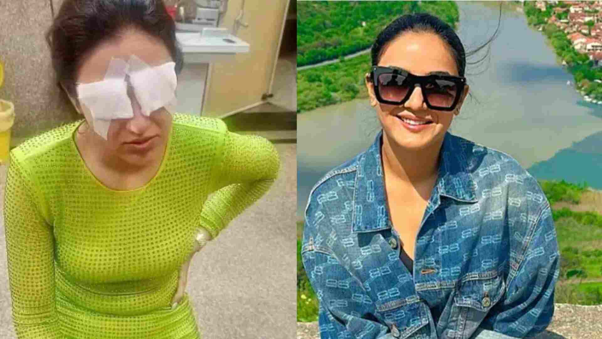 Jasmin Bhasin’s Corneal Damage: A Cautionary Tale For Contact Lens Wearers