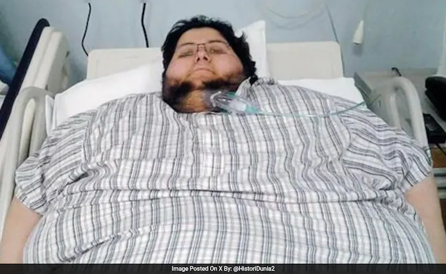 Saudi Man s Stunning 542 Kg Weight Loss From 610 Kg To 63 kg