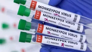 Monkeypox Outbreak: Pakistan Confirms Three New Cases, WHO Alerts