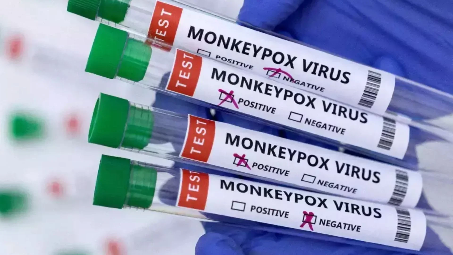 Pakistan Reports First Monkeypox Case of 2024 In 34 Year Old Resident