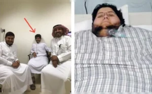 Saudi Man's Stunning 542-Kg Weight Loss