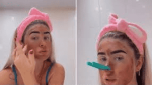 Watch: Woman Uses Poop As Skincare Mask, Experts React