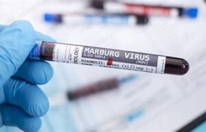 Marburg Virus Outbreak: What You Need To Know And Is India Safe?