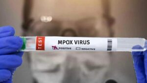 Government Issues Advisory to States and UTs to Prevent Mpox Spread