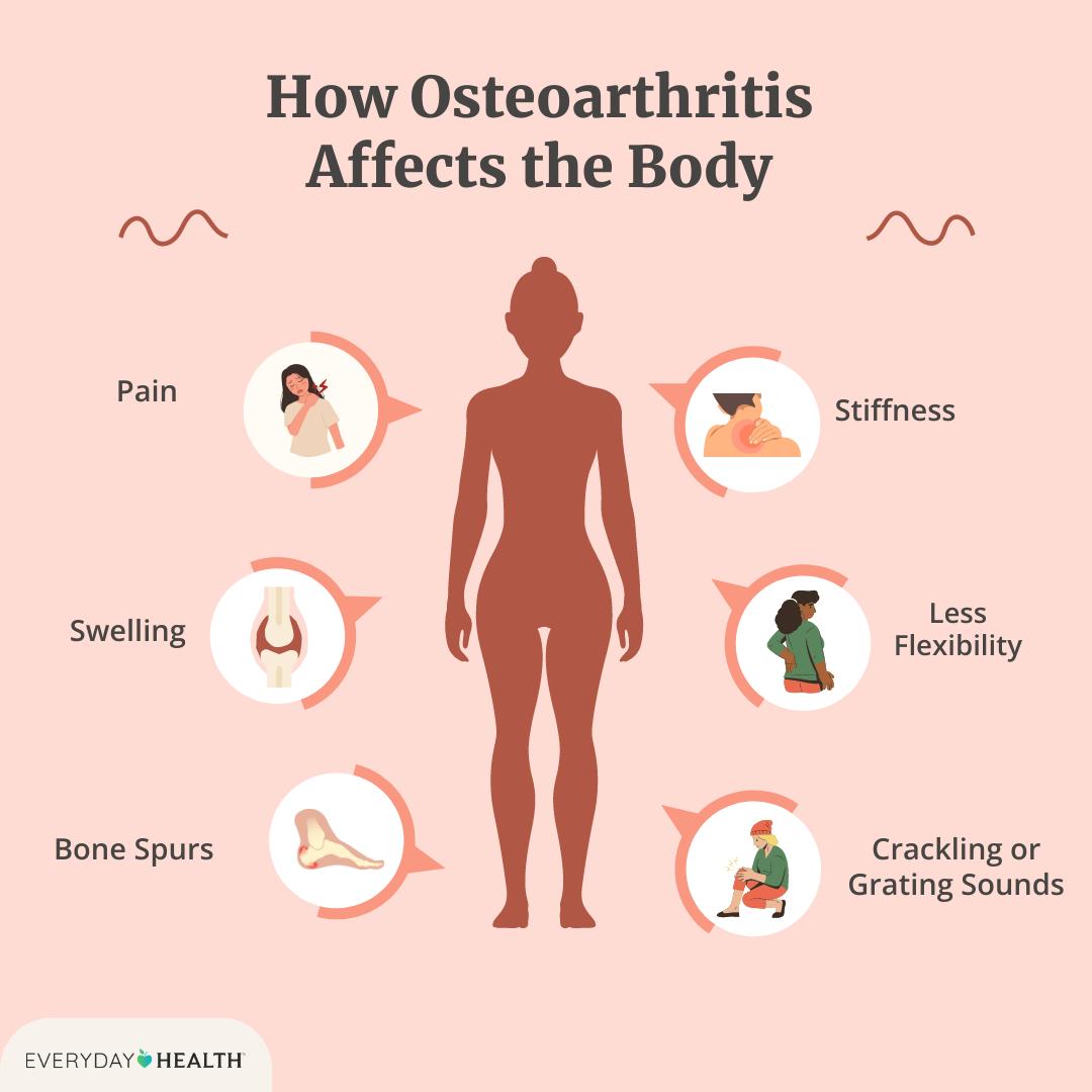 Menopause and Osteoarthritis: How end of reproductive cycle can increase musculoskeletal risks amongst women