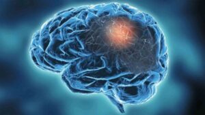 Groundbreaking Study Unveils Innovative Treatment For Neurological Diseases