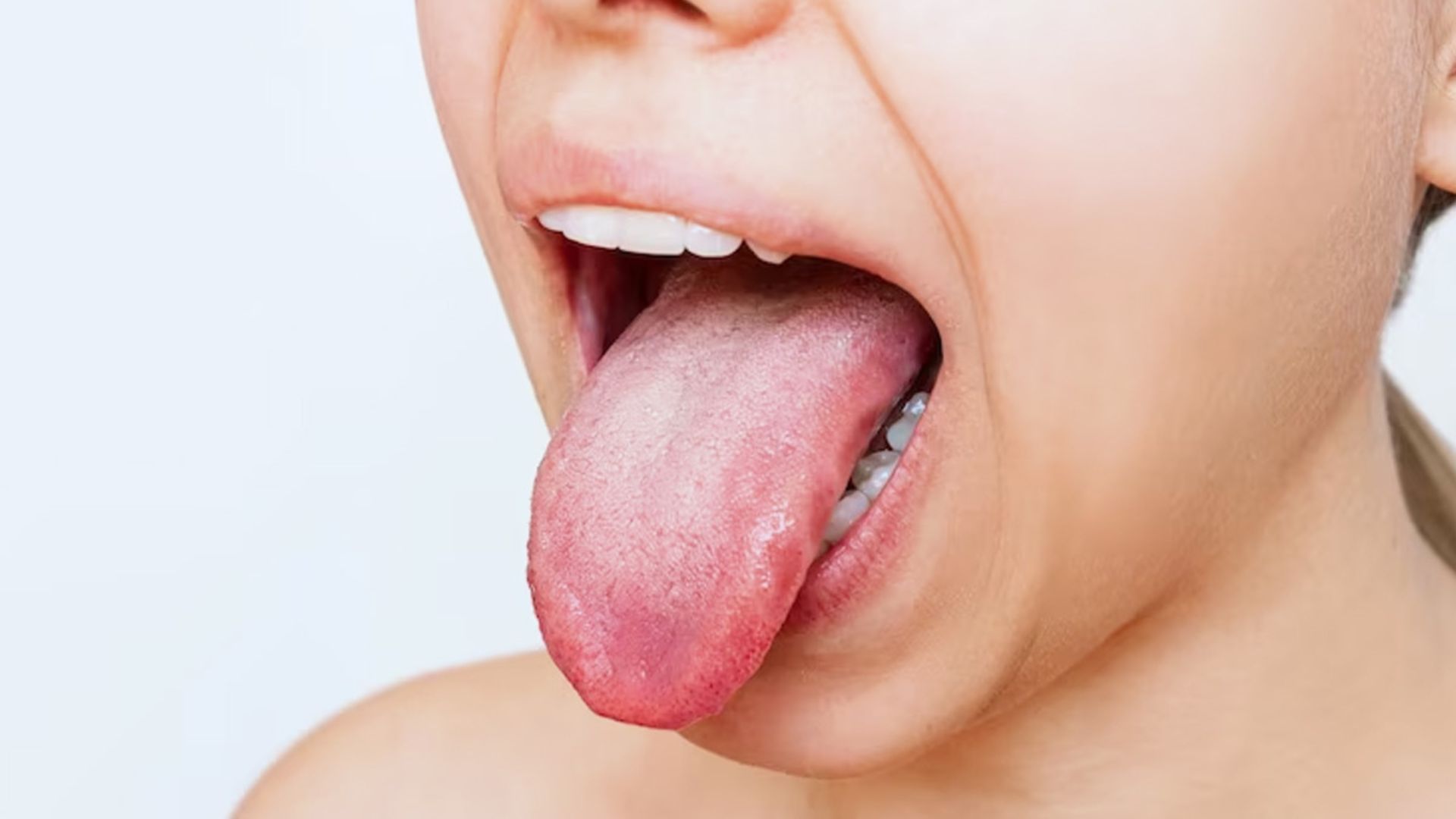 Your Tongue’s Color Could Be A Warning Sign For These Hidden Health Issues