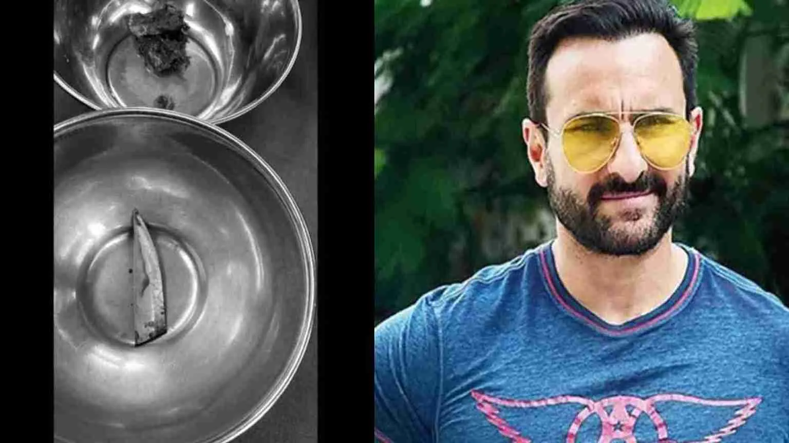 ‘If 2 mm Deeper Knife..’: Doctors On Saif Ali Khan’s Miraculous Recovery