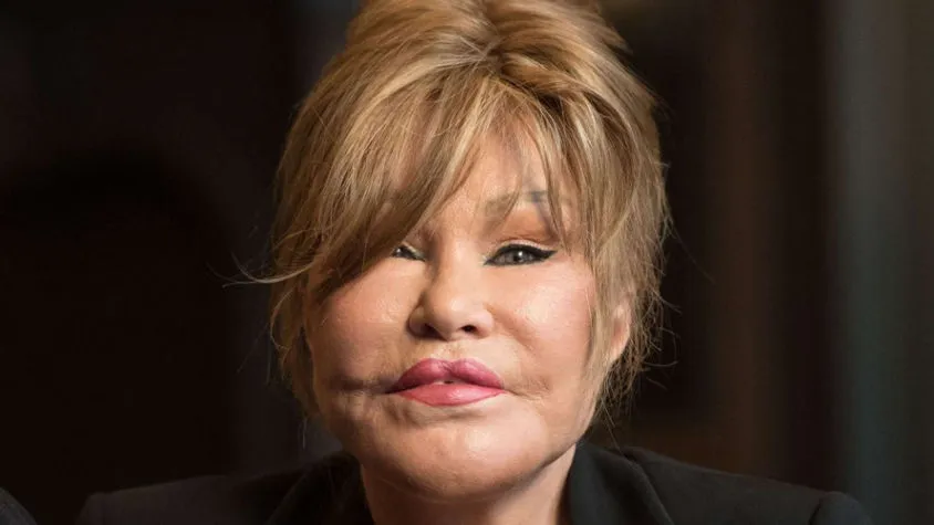 Jocelyn Wildenstein, ‘Catwoman’ Passes Away at 84