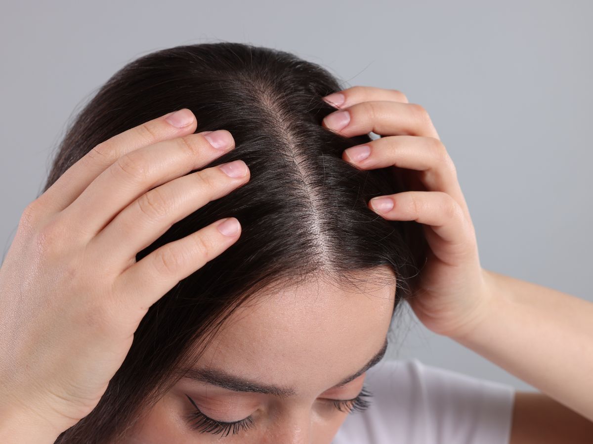 5 Amazing Hacks To Soothe Dry Sensitive Scalp This Monsoon