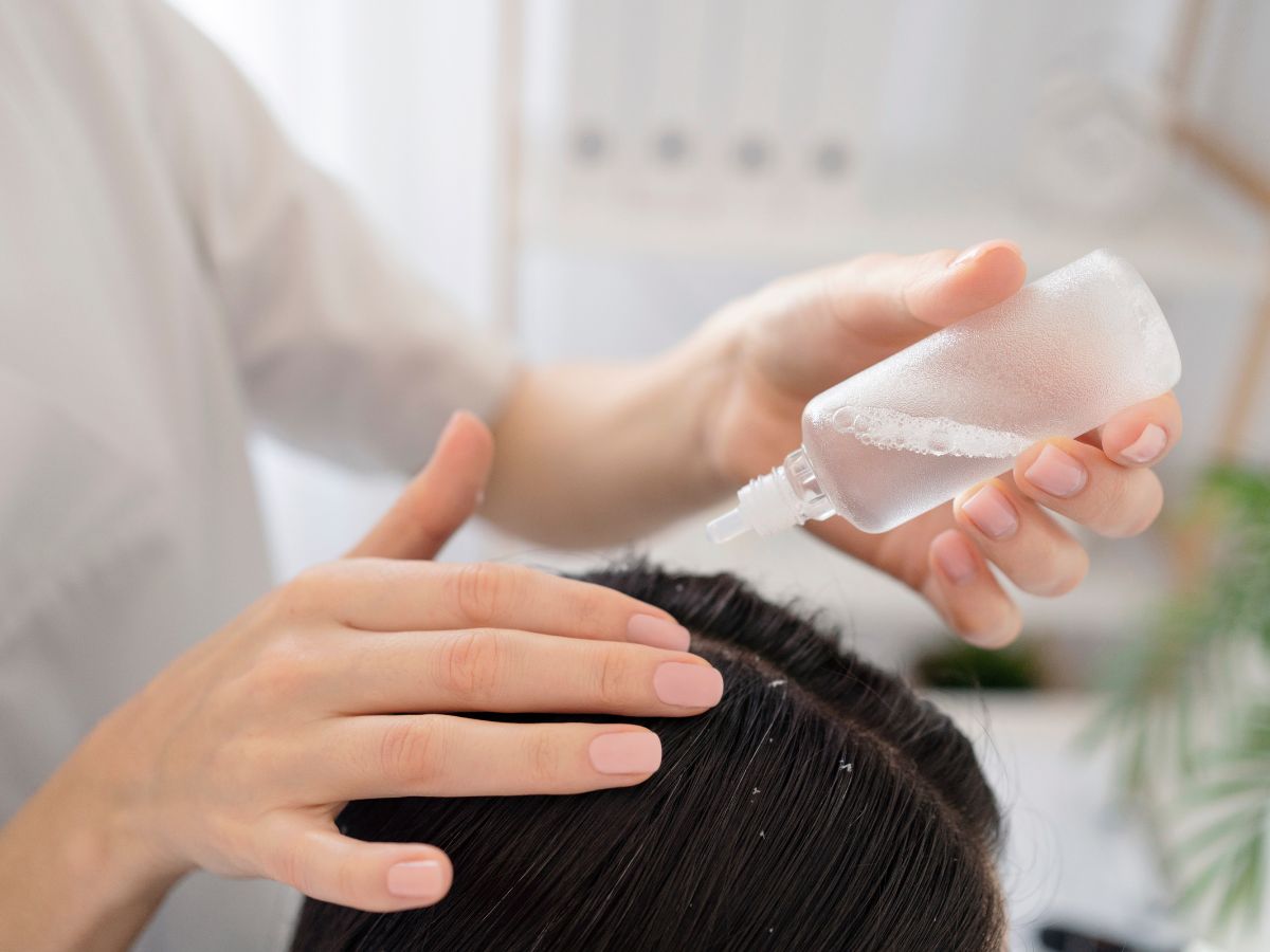 5 Amazing Hacks To Soothe Dry Sensitive Scalp This Monsoon - Gallery Image