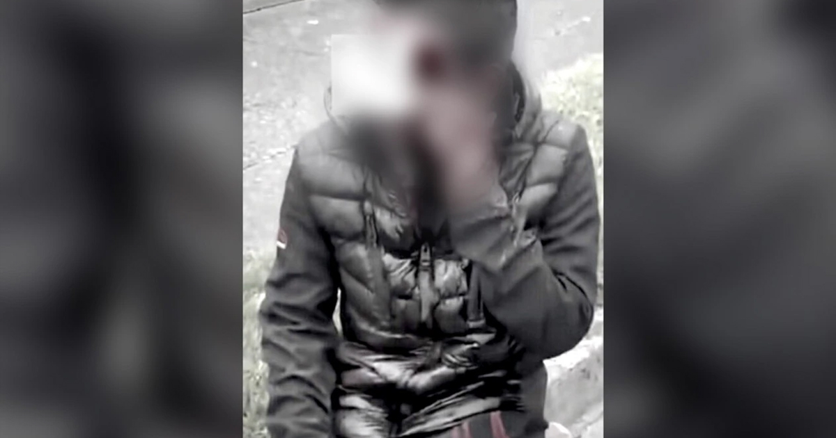 ‘They Took Everything’: Dublin Woman Comforts Stripped Indian Man After Shocking Mob Attack