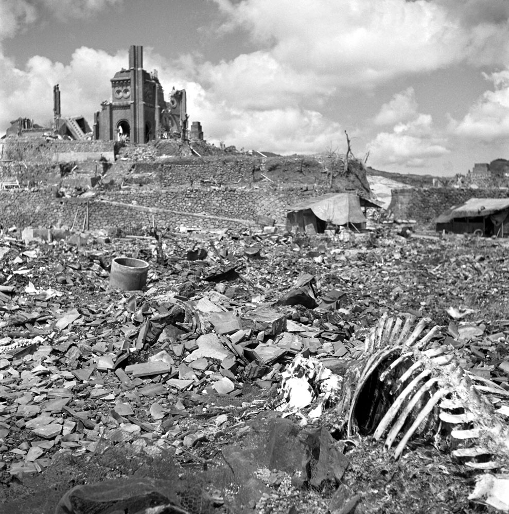 Hiroshima Survivors: Rare Photos of Life After the Atomic Bomb - Gallery Image