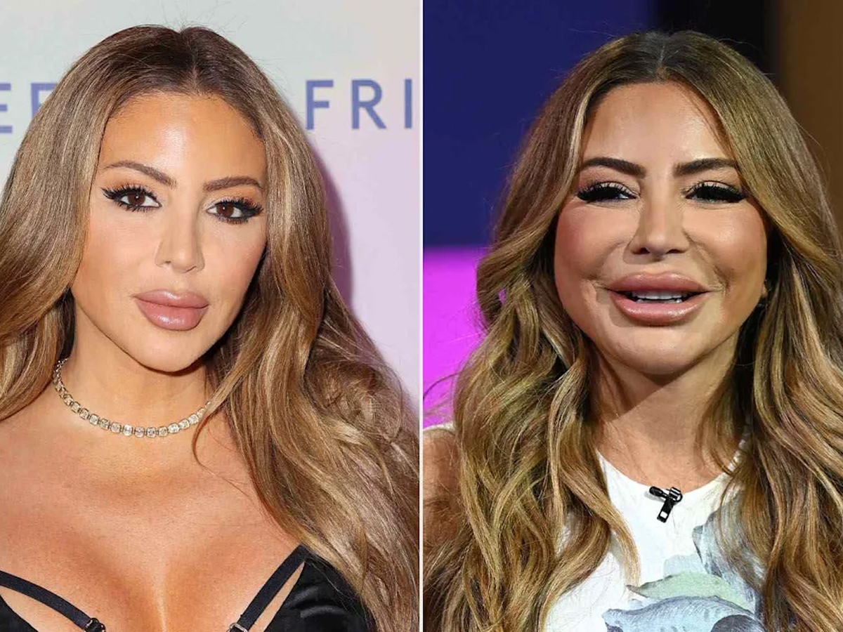 Larsa Pippen Blames PRP Treatment for Swollen Face Amid Cosmetic Procedure Debate | Watch