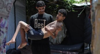 Gaza Starved to Death: How the Body Breaks Down Without Food?