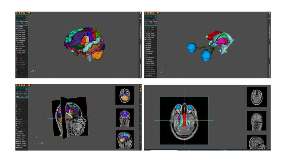 AnaVu: IIIT-Hyderabad's 3D Anatomy Visualization Platform Transforming Medical Education
