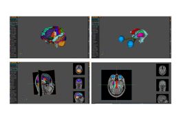 AnaVu: IIIT-Hyderabad's 3D Anatomy Visualization Platform Transforming Medical Education