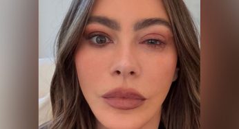 Sofia Vergara misses Emmys due to eye allergy