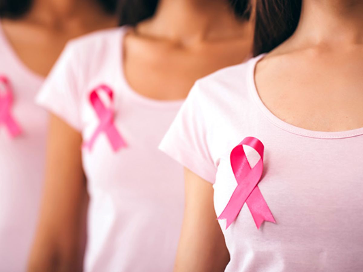 5 Overlooked Signs of Breast Cancer Beyond a Lump
