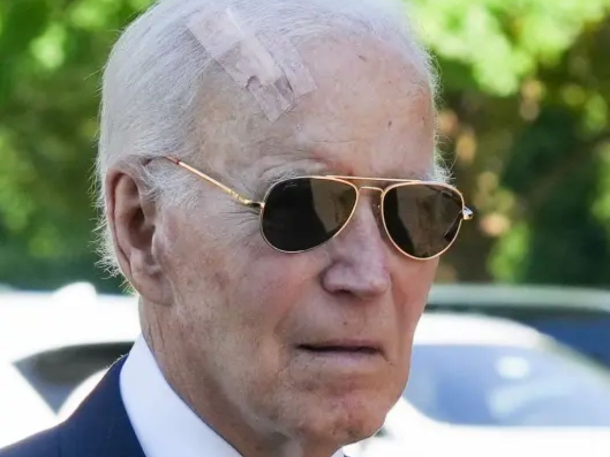 Joe Biden Spotted With Forehead Scar, Here’s What Happened to him? | VIDEO
