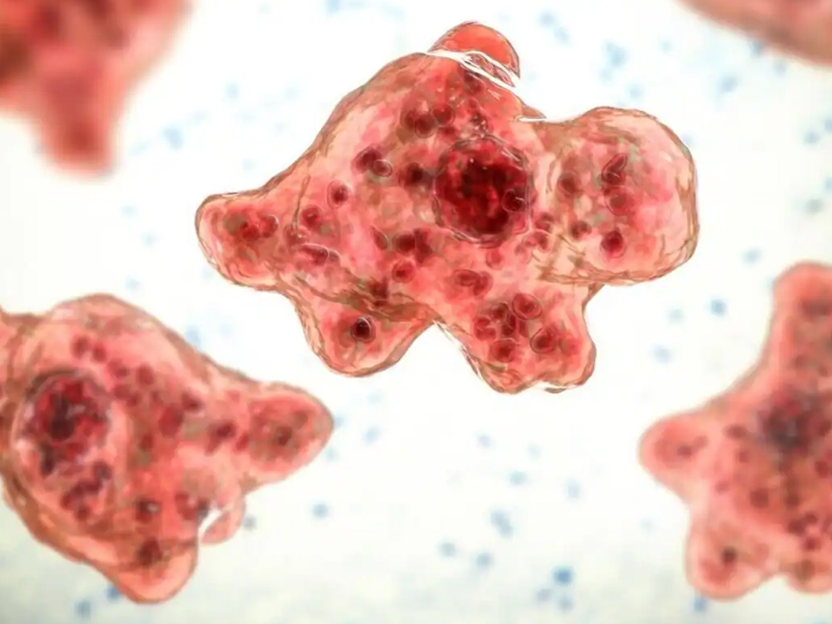Kerala Reports 17 Deaths from Brain-Eating Amoeba, 66 Infected in 2025