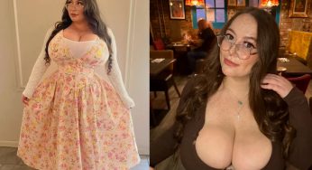 Scottish Woman Says Her Boobs Won’t Stop Growing Due to Rare Condition—& the Harassment She Faces