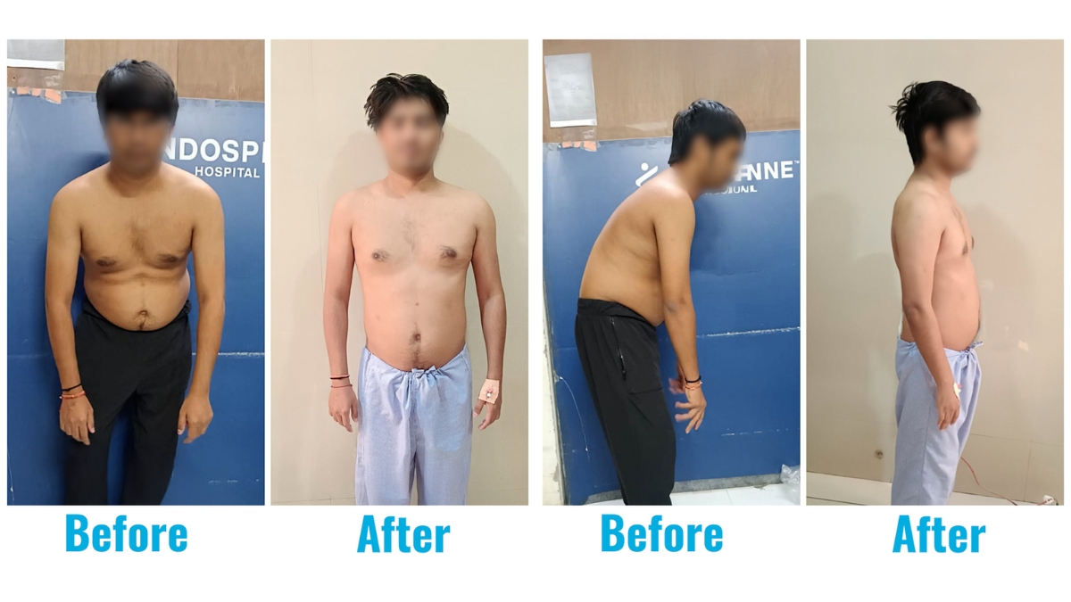 A 31-year-old who lived on a chair… until his spine finally said, ‘Enough’