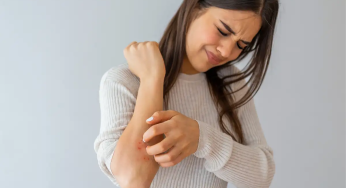 Don’t Ignore Post-Holi Skin Reactions: Expert Advice for Quick Recovery